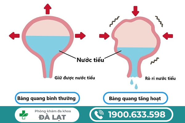 Hình ảnh minh họa